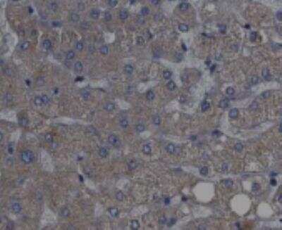 Immunohistochemistry: p70 S6 Kinase/S6K [p Thr389/412] Antibody [NB600-1049]